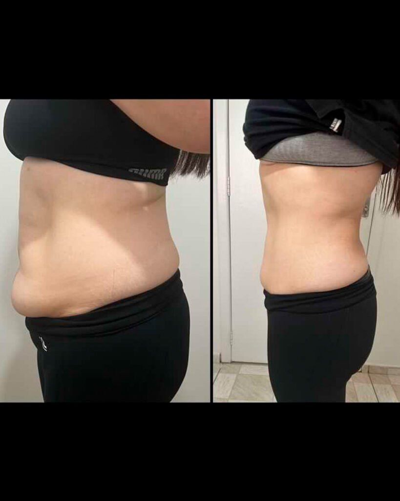 Antes e depois: Resultado real · aluna