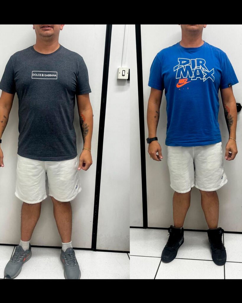 Antes e depois: Resultado real · aluno