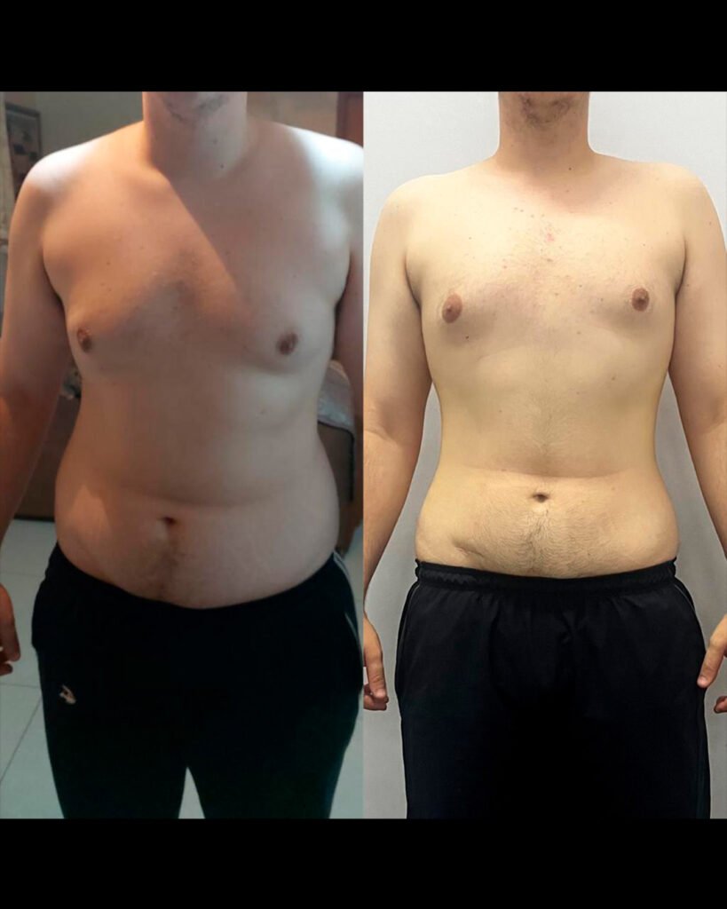 Antes e depois: Resultado real · aluno
